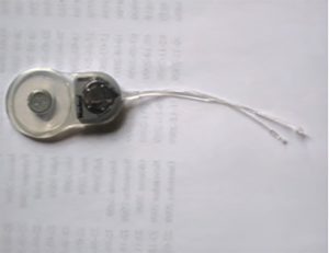 The Cochlear Implant